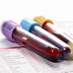Blood test for drugs and alcohol samples