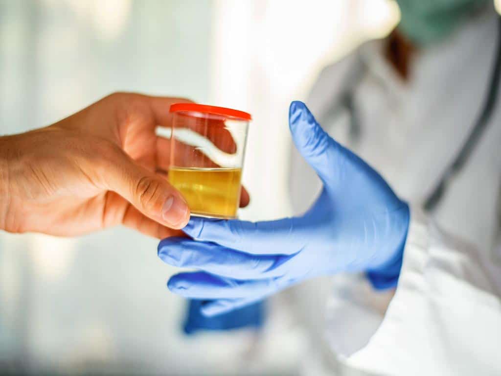 A person handing a urine sample to lab technician