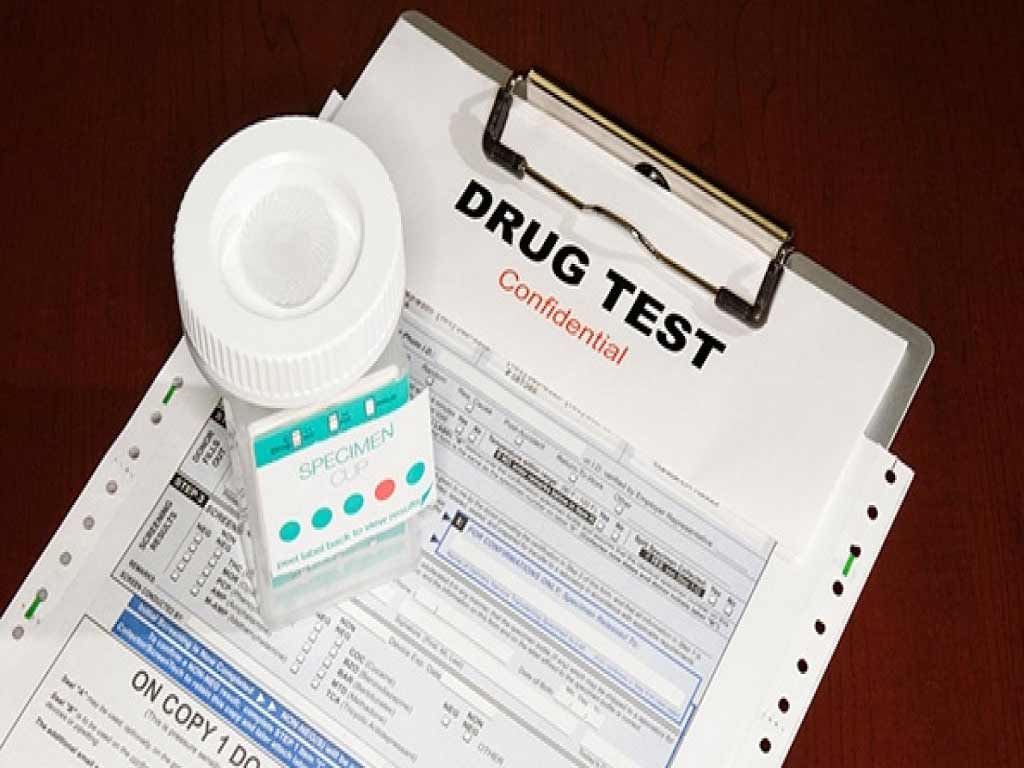 A form showing the results of a drug test and a testing cup on top