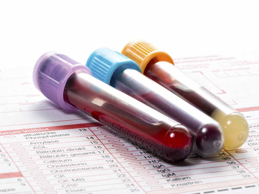 Three vials of blood placed on top of a document