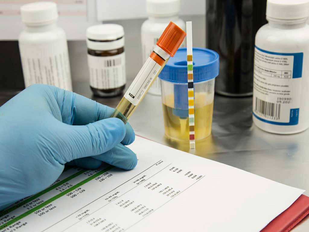 A lab technician holding a urine sample at a table with other things on top