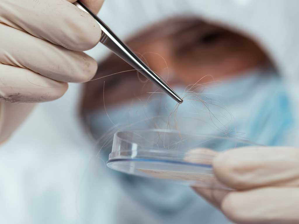 A lab technician holding hair strands in tweezers