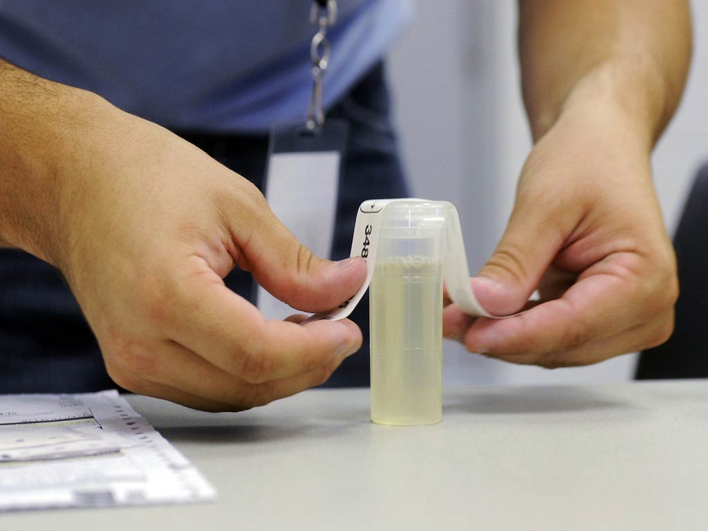 A professional placing a label on a urine sample