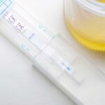A dipstick test kit and a urine sample