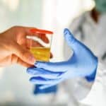 A person handing over a urine cup sample to a lab technician