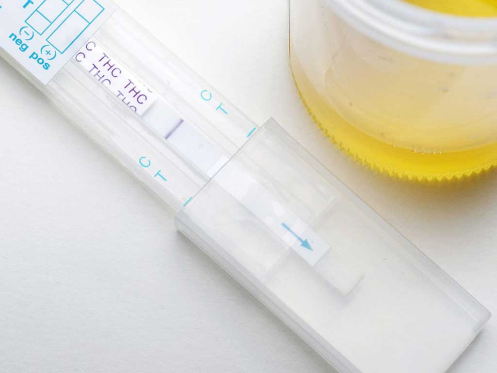 A test kit showing THC next to a urine sample