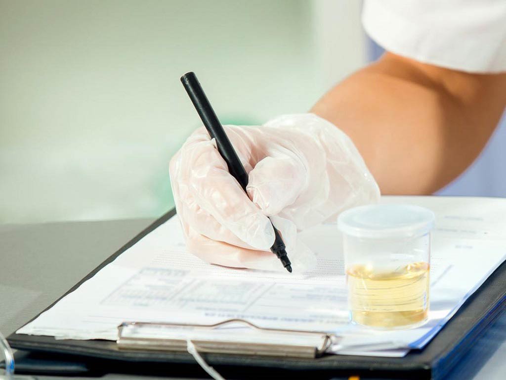 A healthcare professional filling up a form while a urine sample container is on top of it