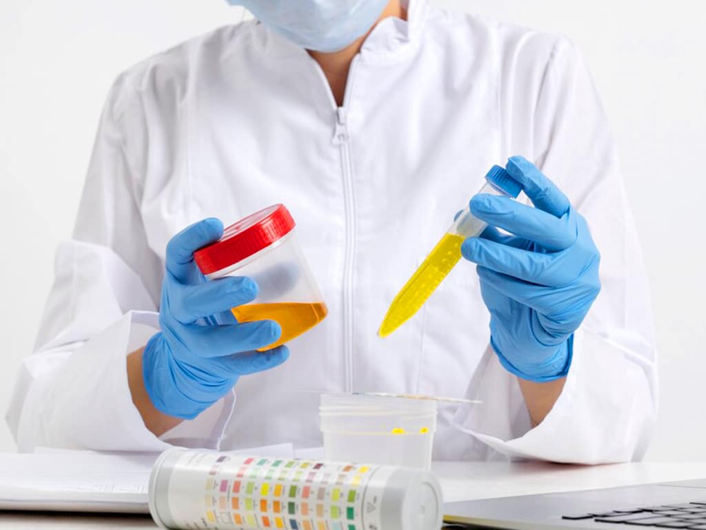 A lab professional holding samples of urine in both hands