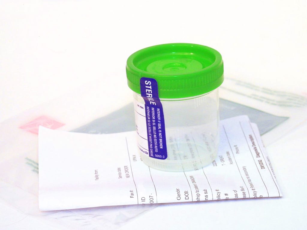 A sealed empty collection container for urine with green lid