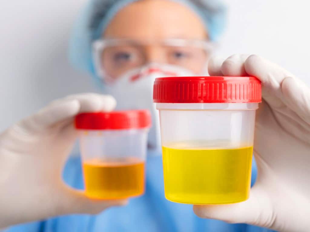 A health professional in PPE holding two containers of urine samples