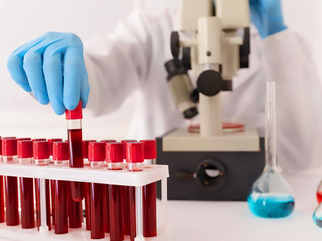 A lab technician picking a vial of blood from a rack for analysis