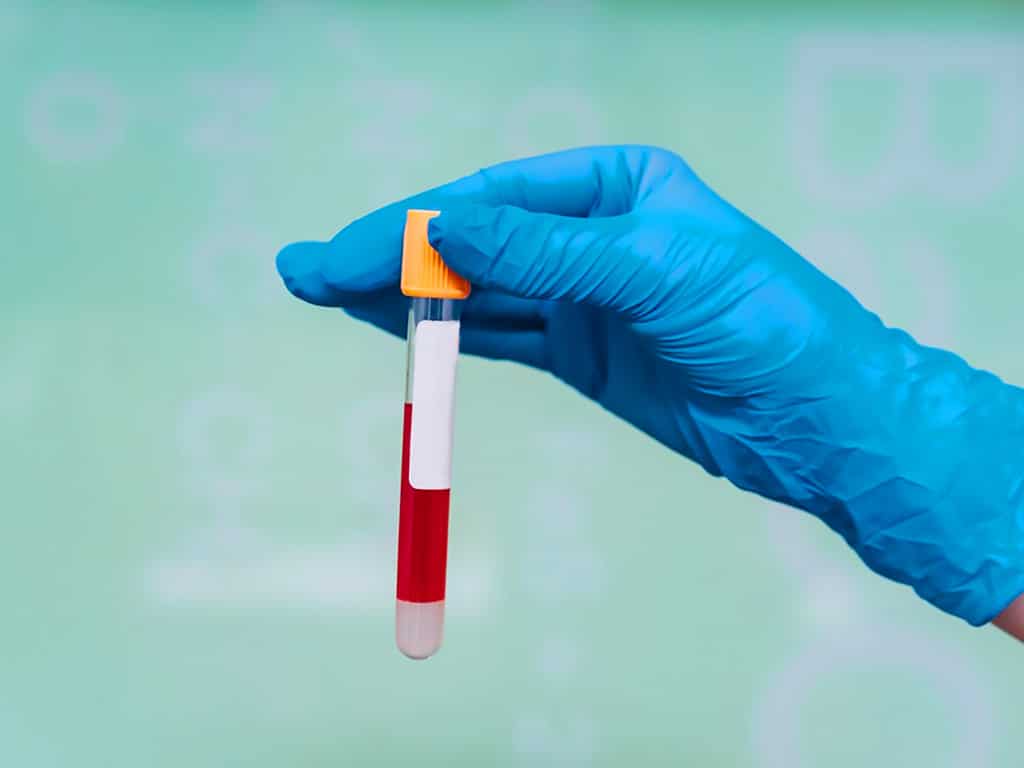 A globed hand holding a sample of blood in a tube