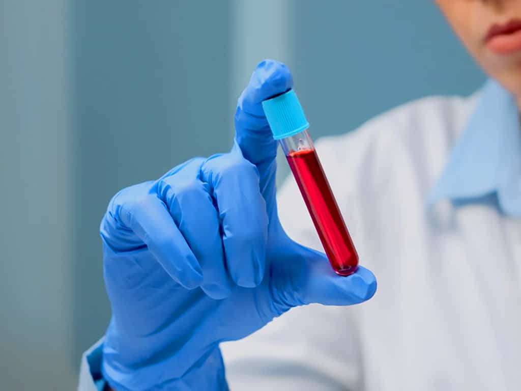 A person wearing gloves holding a blood sample