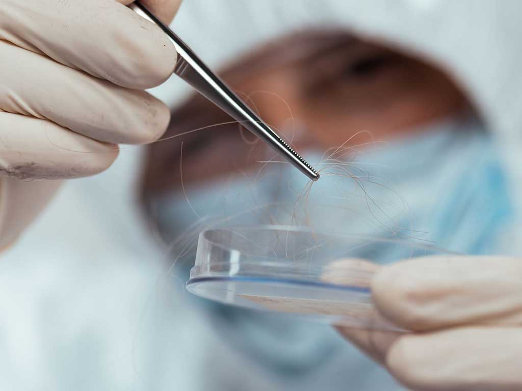 A lab technician holding hair samples with a tweezer