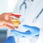 A person handing a urine sample to a lab technician