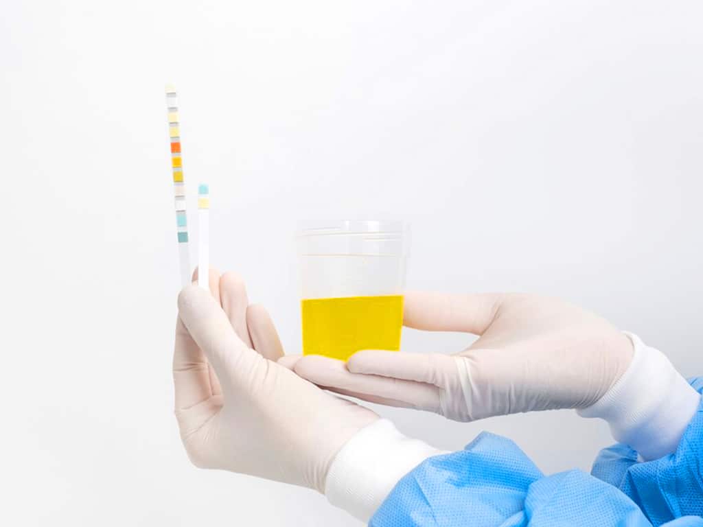 A lab technician holding a urine sample and a test strip
