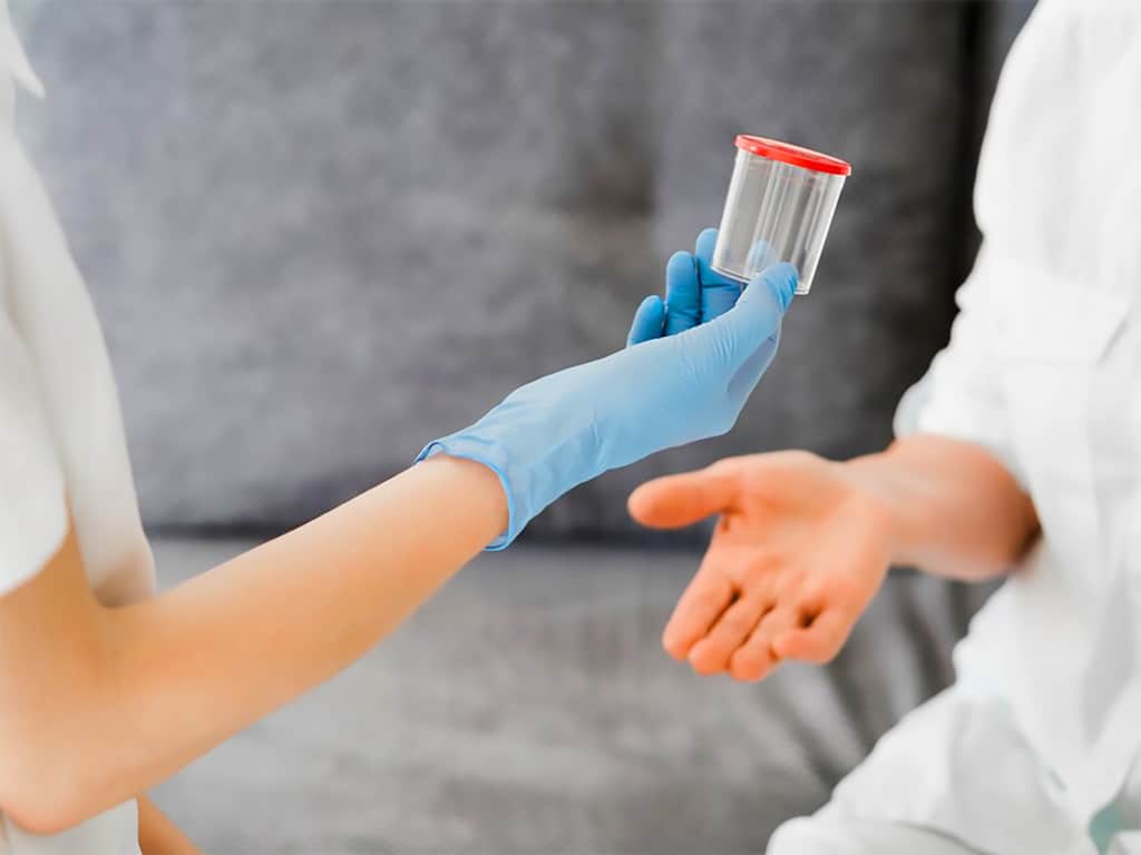 A lab personnel giving an urine sample cup to a patient